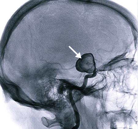 Локализация