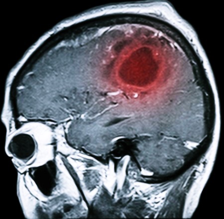 Схематическое изображение