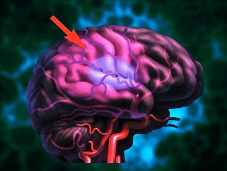 Мертвый участок