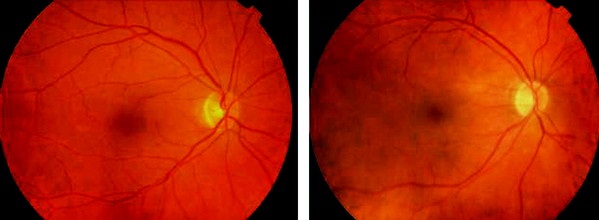 Здоровый и больной