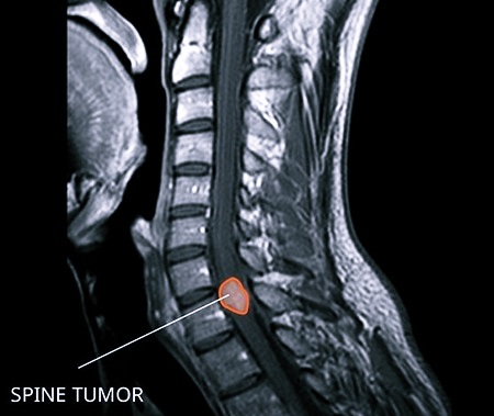 Новообразование