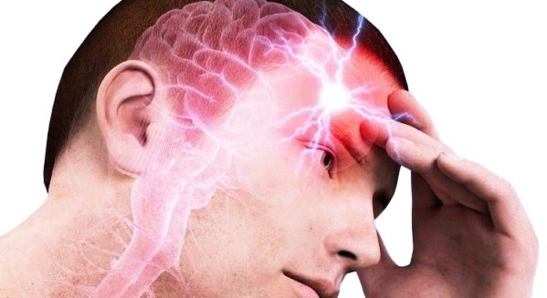 Головная боль