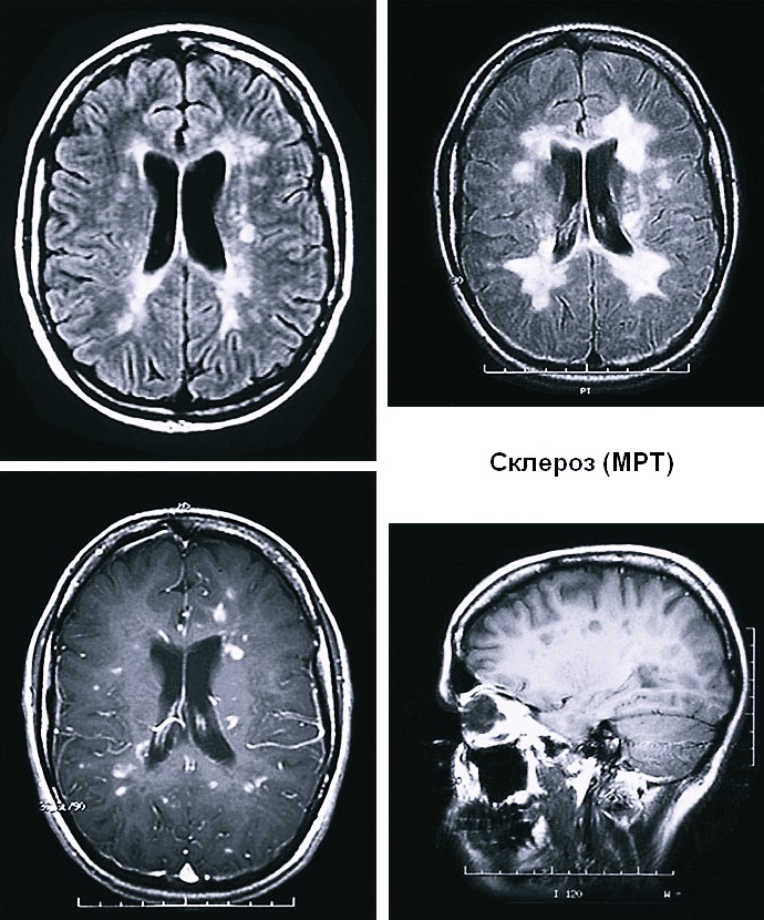 Томограмма