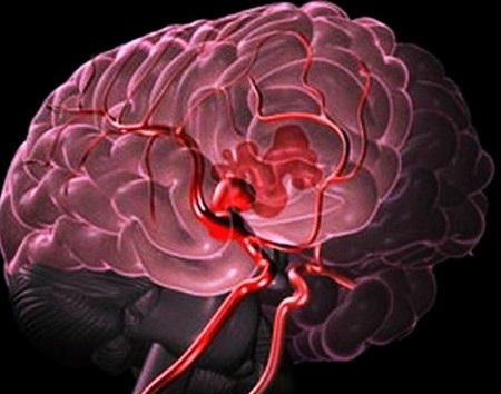 Последствия