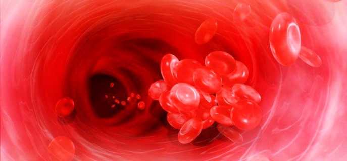 Почему возникают тромбы в голове, и чем опасно такое состояние