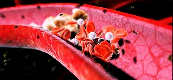 Какие продукты питания лучше всего чистят кровеносные сосуды