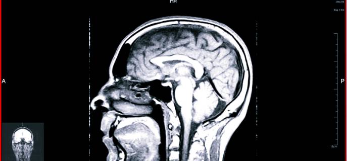 Лучшие методы обследования головы