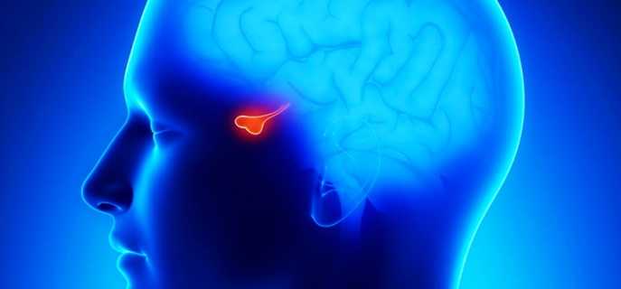 Что такое аденома гипофиза