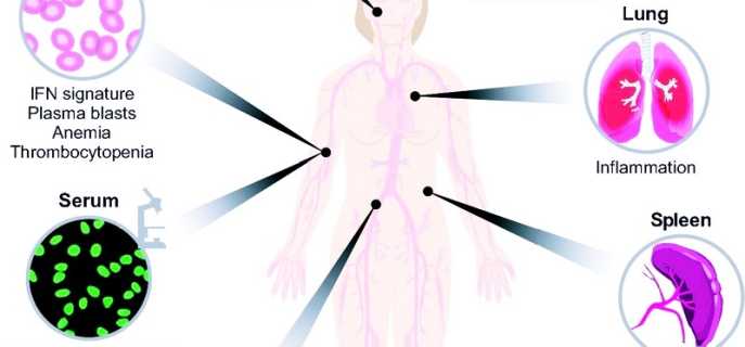 Заразна ли системная красная волчанка