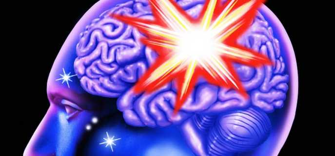 Кровоизлияние в головной мозг