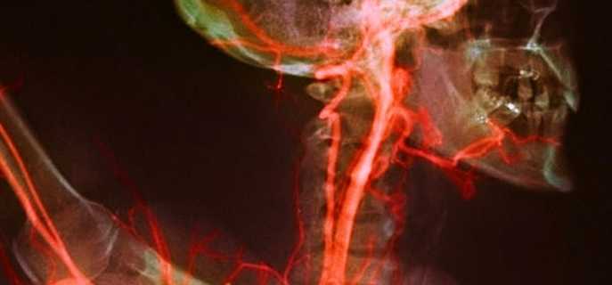 Строение сосудистой системы головы и шеи, её патологии и лечение