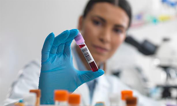 Лаборант делает анализ крови