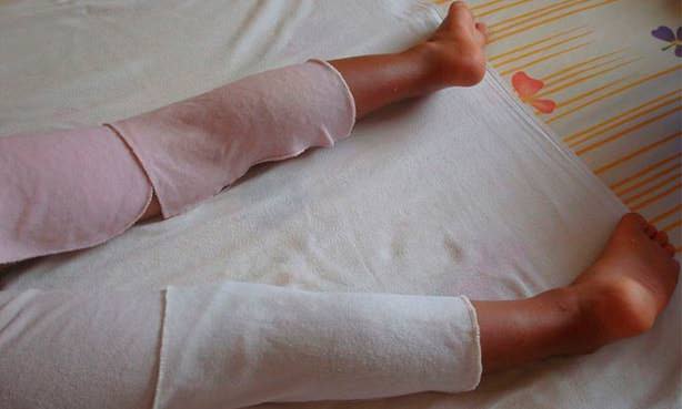 Компресс с уксусом