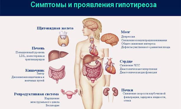 Симптомы гипотиреоза