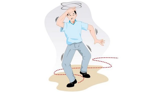 Нарушение равновесия, головокружение