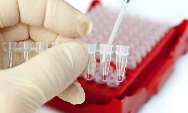 Исследование крови на глюкозу и холестерин