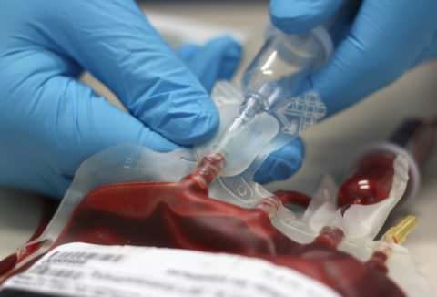 syndrom_viskota_oldrycha_lechenie Синдром Вискотта-Олдрича: патогенез