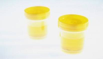 Повышенные эритроциты в моче