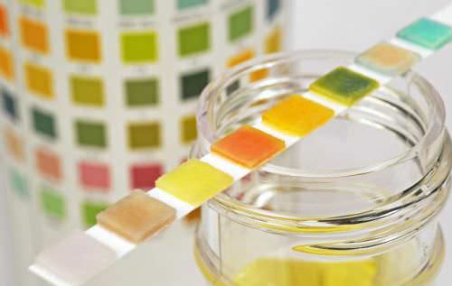 Анализ мочи Анализ мочи