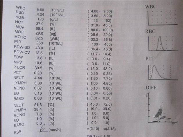 RDW в анализе крови