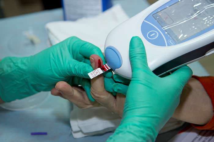 Исследование крови на МНО и ПТИ