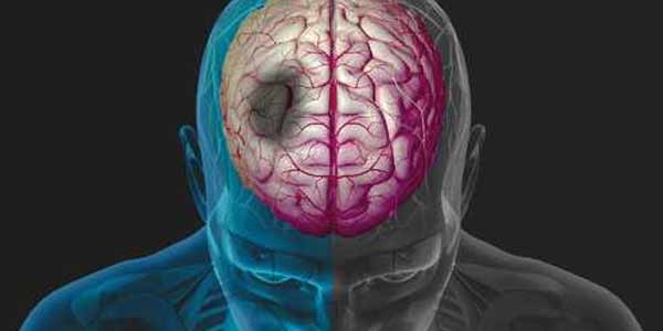 проблемы костного мозга