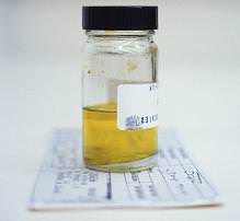 Общий анализ мочи у взрослых