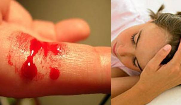 Сепсис крови что это такое, последствия и лечение