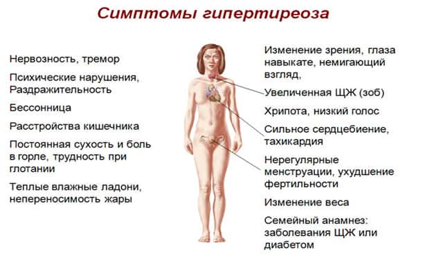 Симптомы гипертиреоза