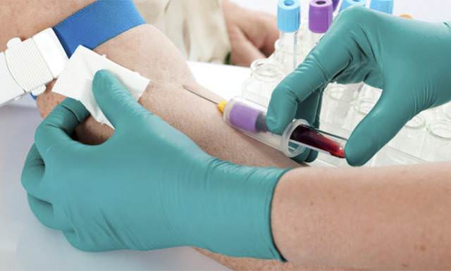 Анализ на липопротеины из вены