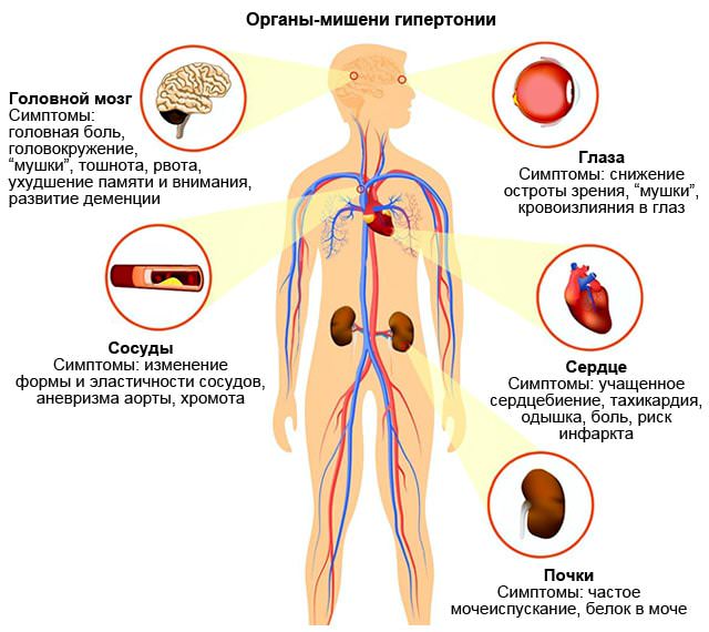 Органы мишени при гипертонии