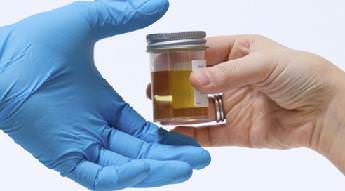 слизь в моче расшифровка