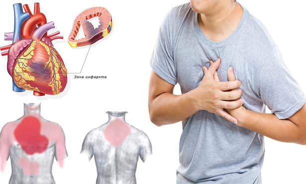 Ощущения при инфаркте