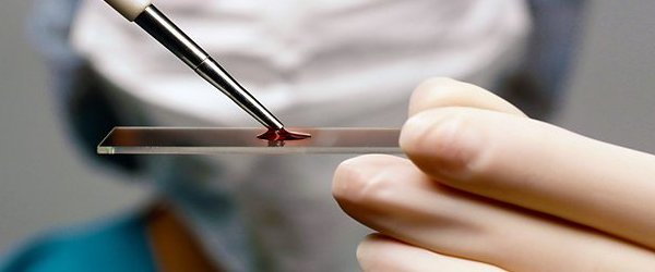 анализ крови