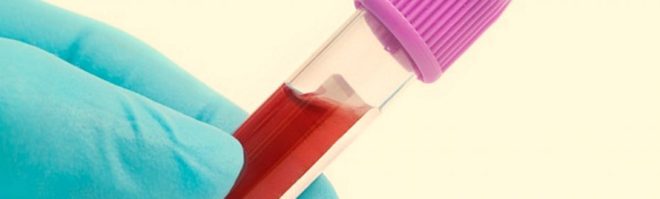 кровь в пробирке