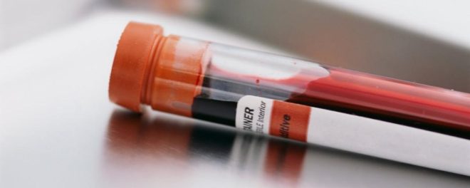 что такое СОЭ