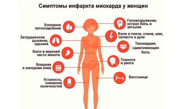 Типичные симптомы ИМ у женщины