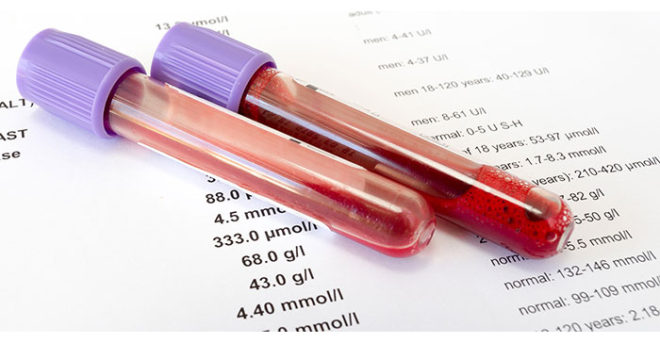 анализ крови