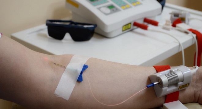 Лазерная чистка крови