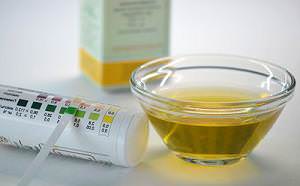 сахар в моче