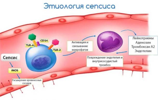Сепсис крови что это такое, последствия и лечение