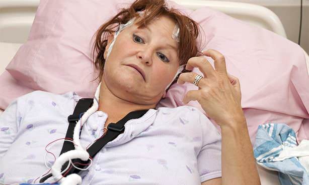 Парализована рука после инсульта