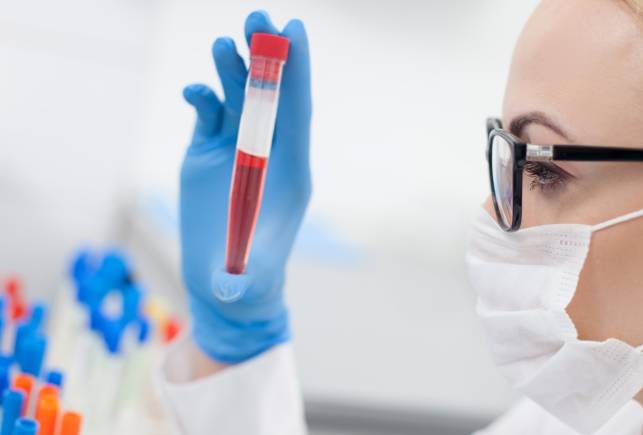 Общий анализ крови при ВИЧ показатели, указывающие на вирус