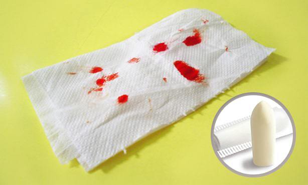 Ректальный суппозиторий при геморрое с кровью