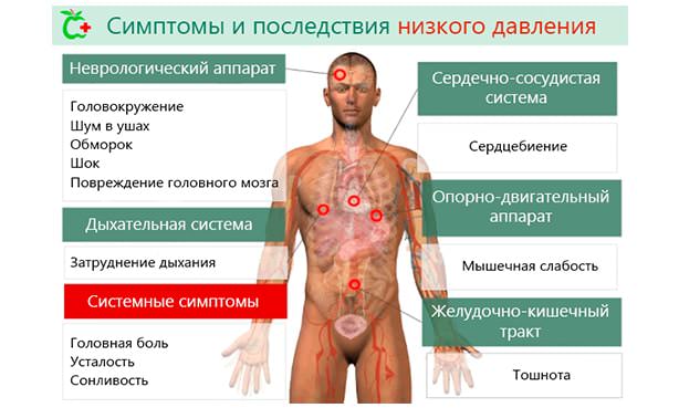 Симптомы гипотонии