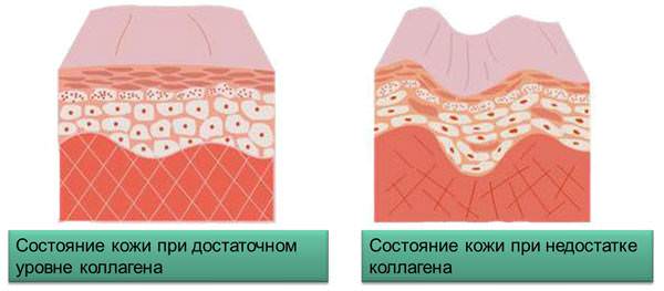Влияние коллагена на здоровье кожи