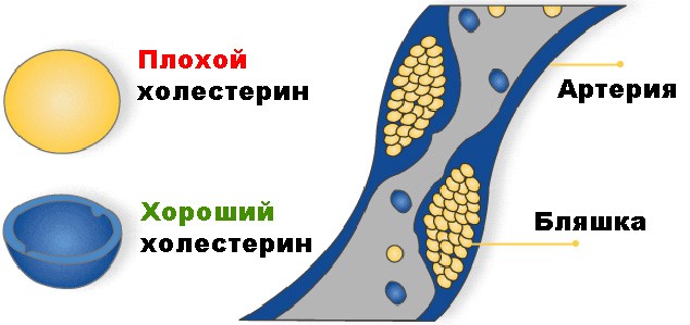 хороший и плохой холестерин