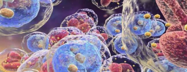 хронический лейкоз