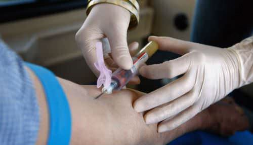 Забор крови из вены