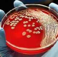 бак посев мочи расшифровка